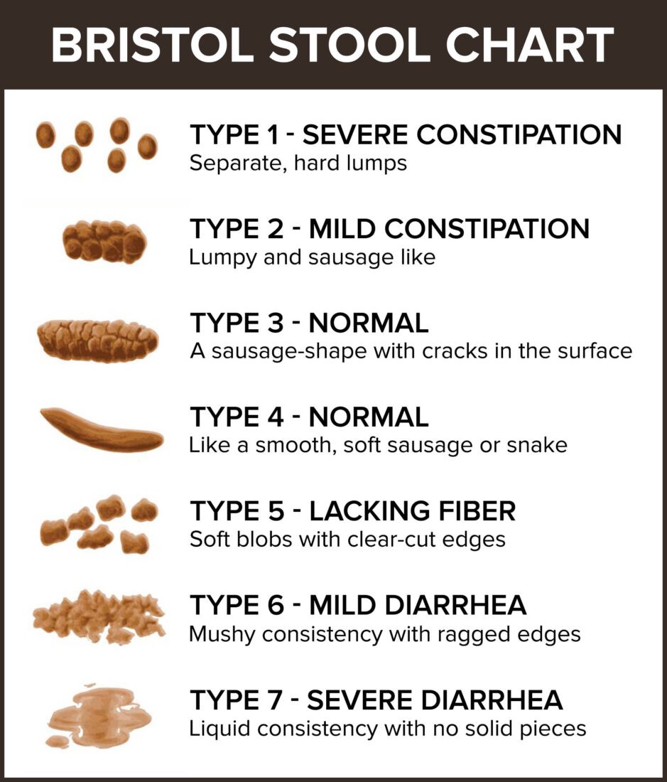 Healthy Poop: Daily Poop Journal | Bowel Movement Health Tracker | Bristol  Type Chart | Food & Stool Log