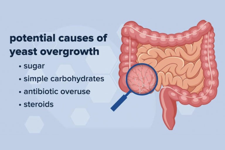 Yeast Overgrowth in Autism The Autism Community in Action